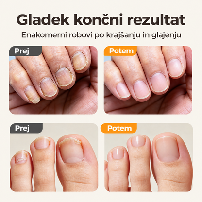 Rezultat pred in po negi